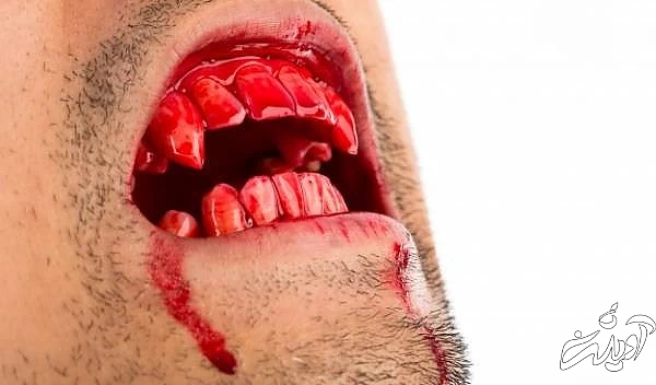 خون آشام در ایران باستان